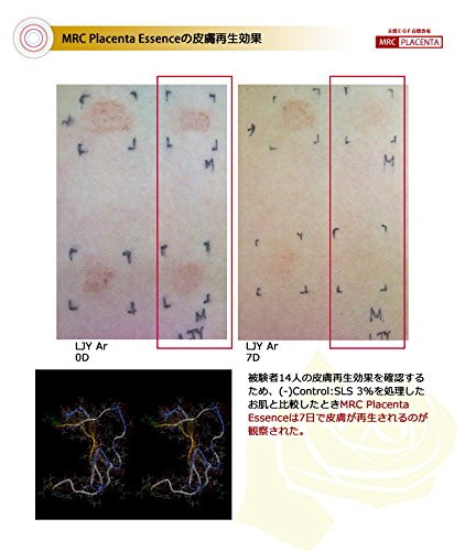 MRCプラセンタエッセンス 25ml(5ml×5）