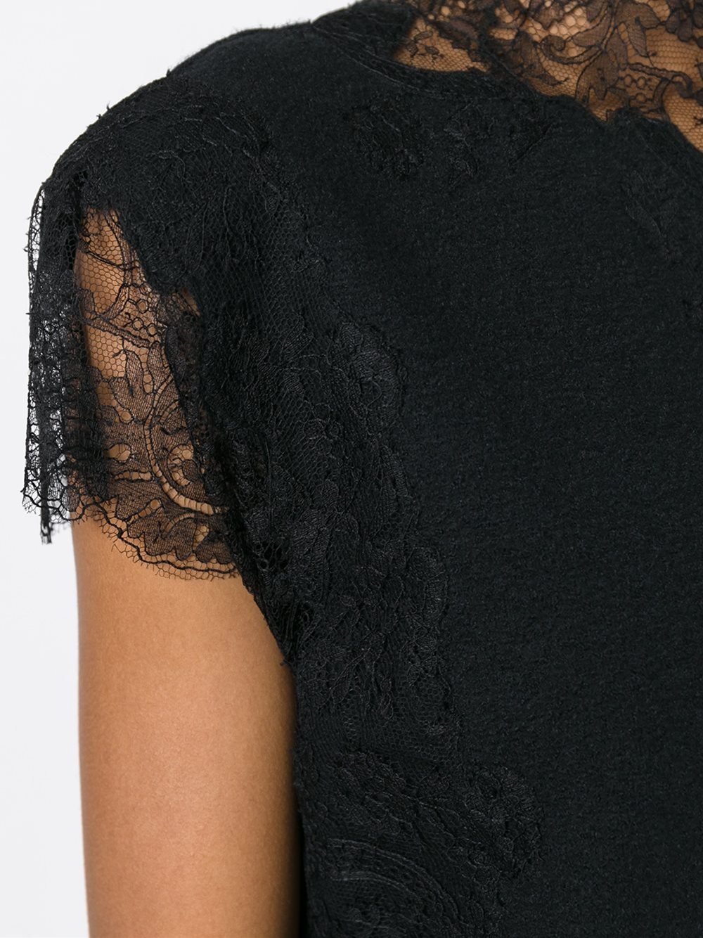 lace detailing dress