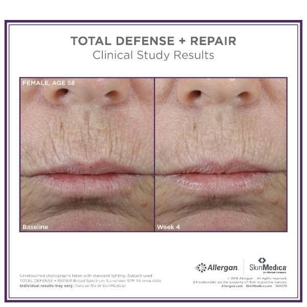 SkinMedica Total Defense and Repair SPF 34