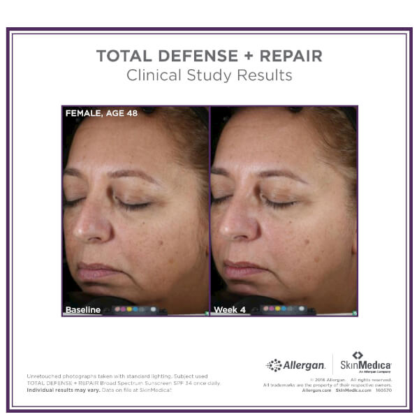 SkinMedica Total Defense and Repair SPF 34