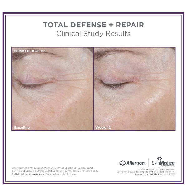 SkinMedica Total Defense and Repair SPF 34