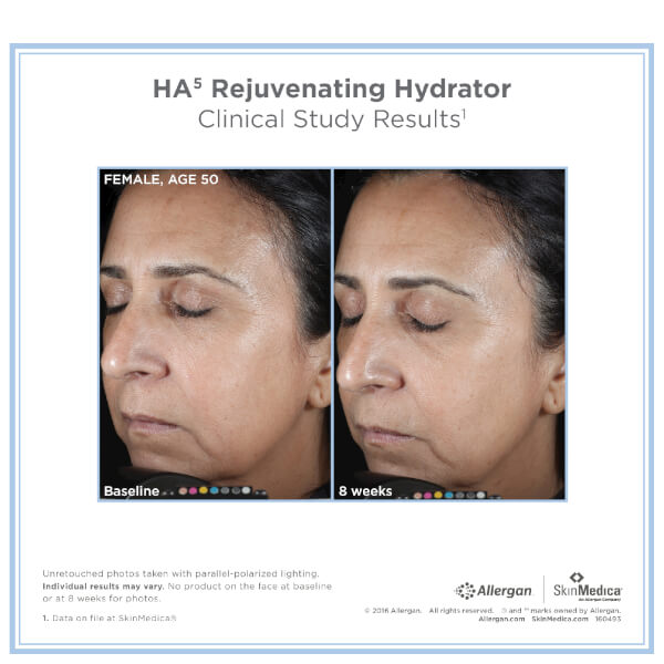 SkinMedica HA5 Rejuvenating Hydrator (2oz)