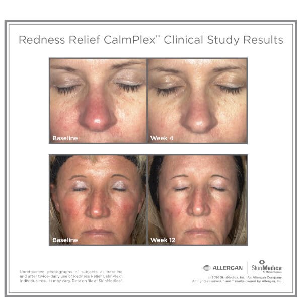 SkinMedica Redness Relief CalmPlex (1.6oz)