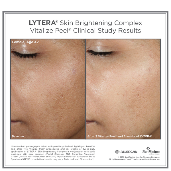 SkinMedica LYTERA Skin Brightening Complex (2 oz)