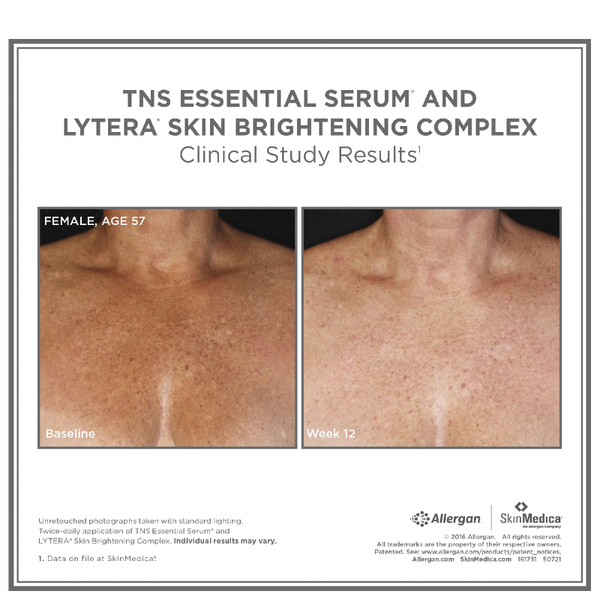 SkinMedica LYTERA Skin Brightening Complex (2 oz)