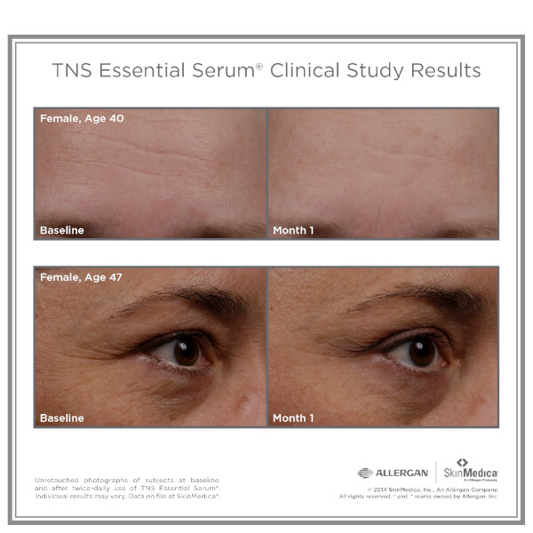 SkinMedica TNS Essential Serum (1oz)